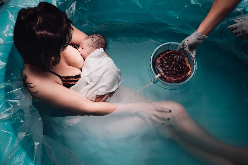 A pillanat, amikor a nőből édesanya válik – 24+24 szülésfotó (2)